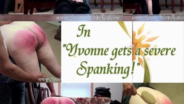 Yvonne's Severe Spanking!